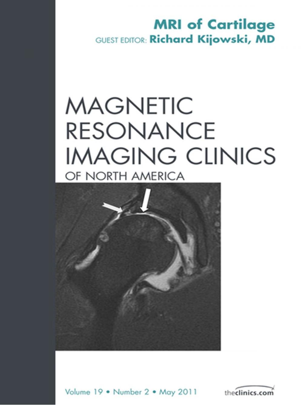 Big bigCover of Cartilage Imaging, An Issue of Magnetic Resonance Imaging Clinics - E-Book