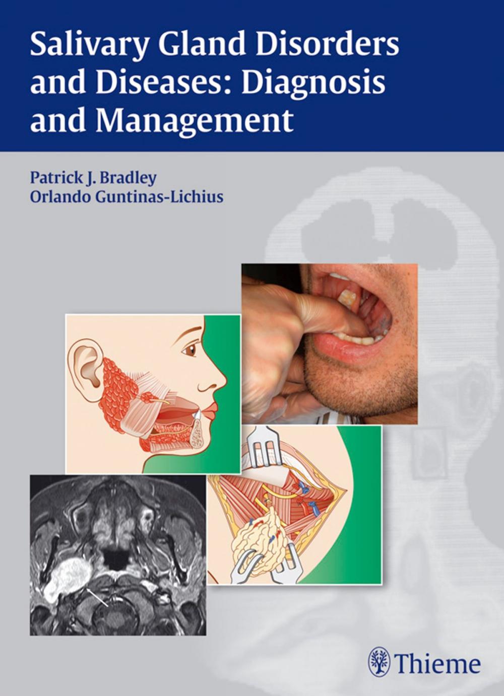 Big bigCover of Salivary Gland Disorders and Diseases: Diagnosis and Management