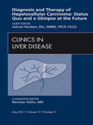 Cover of the book Hepatocellular Carcinoma, An Issue of Clinics in Liver Disease - E-Book by Judit Pongracz, BSc, PhD, DrHabil, Mary Keen, BSc, PhD