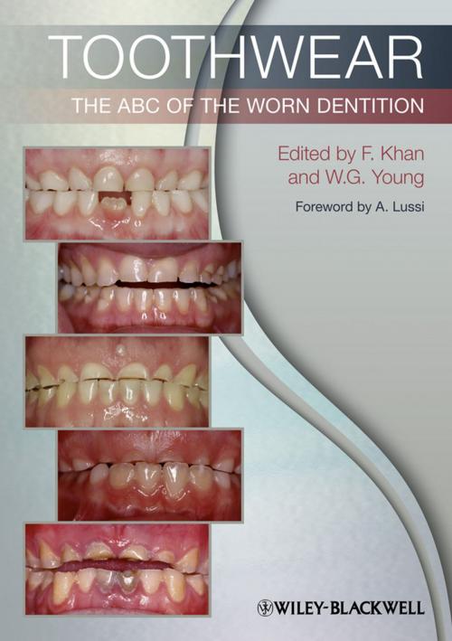 Cover of the book Toothwear by , Wiley