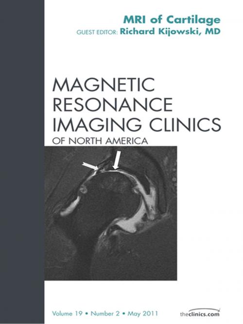 Cover of the book Cartilage Imaging, An Issue of Magnetic Resonance Imaging Clinics - E-Book by Richard Kijowski, MD, Elsevier Health Sciences