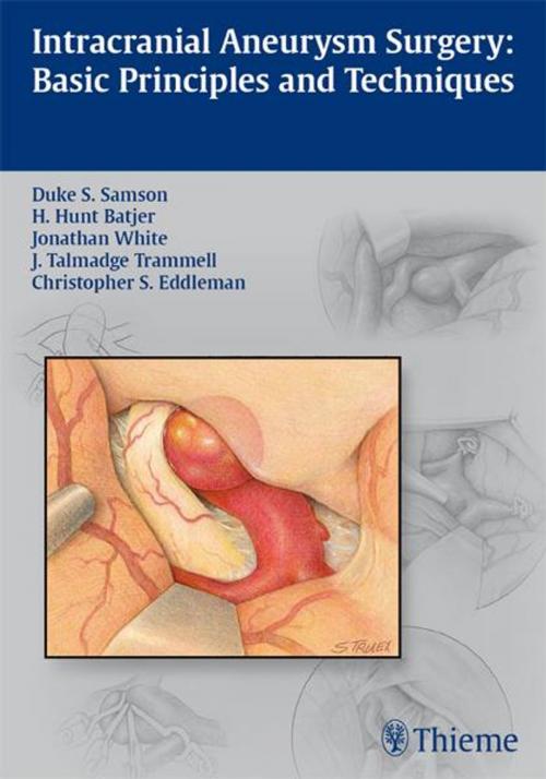 Cover of the book Intracranial Aneurysm Surgery by , Thieme