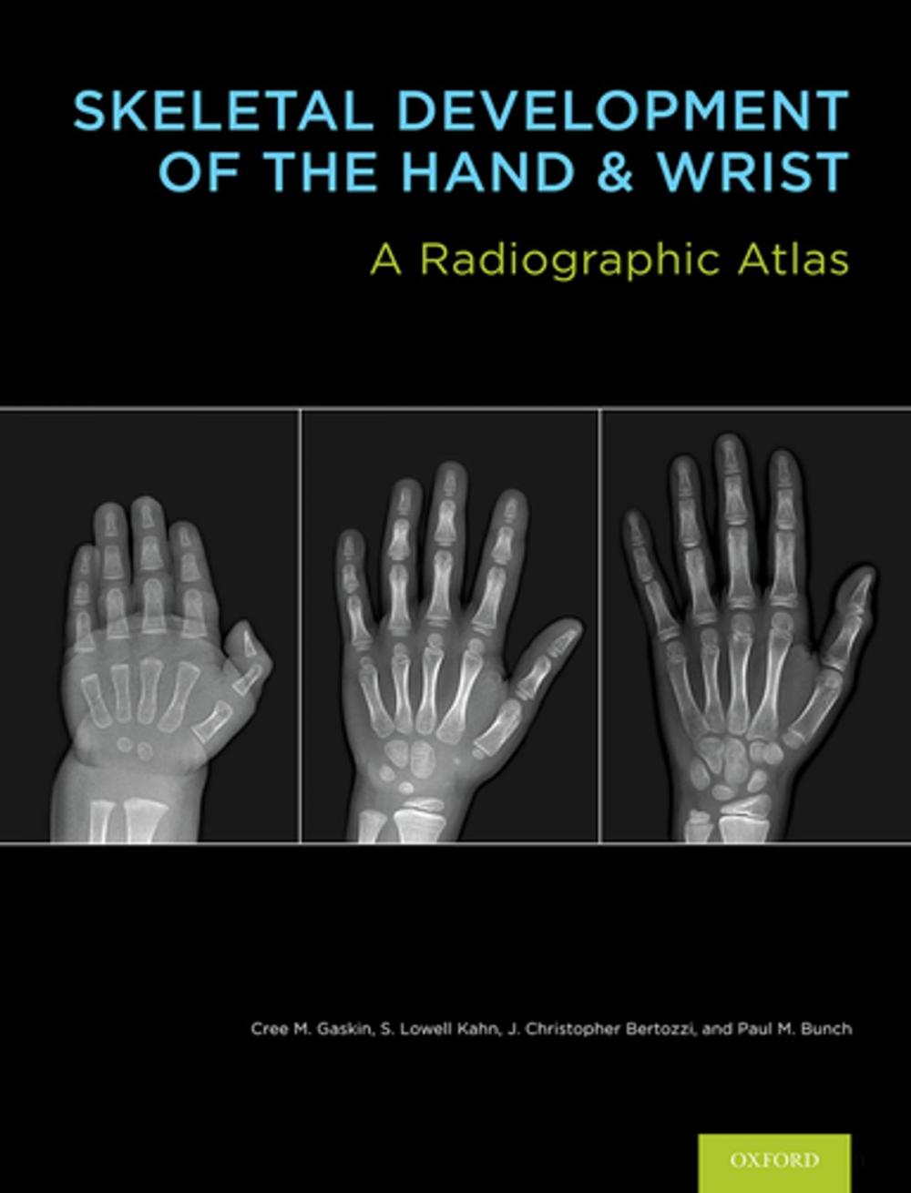 Big bigCover of Skeletal Development of the Hand and Wrist