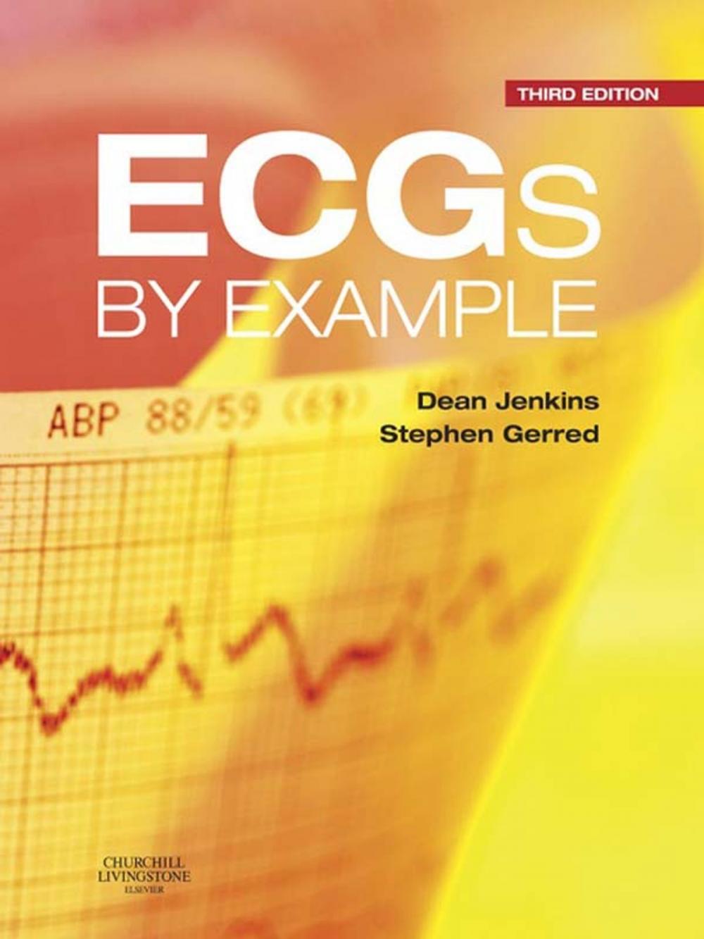 Big bigCover of ECGs by Example E-Book