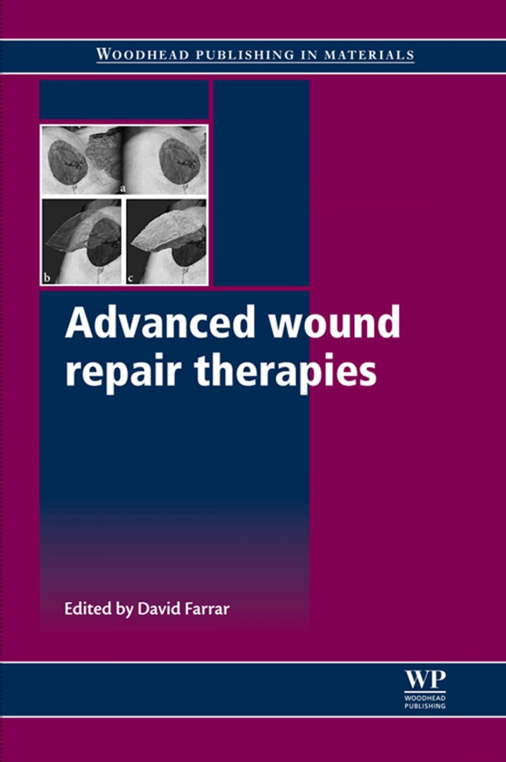 Big bigCover of Advanced Wound Repair Therapies