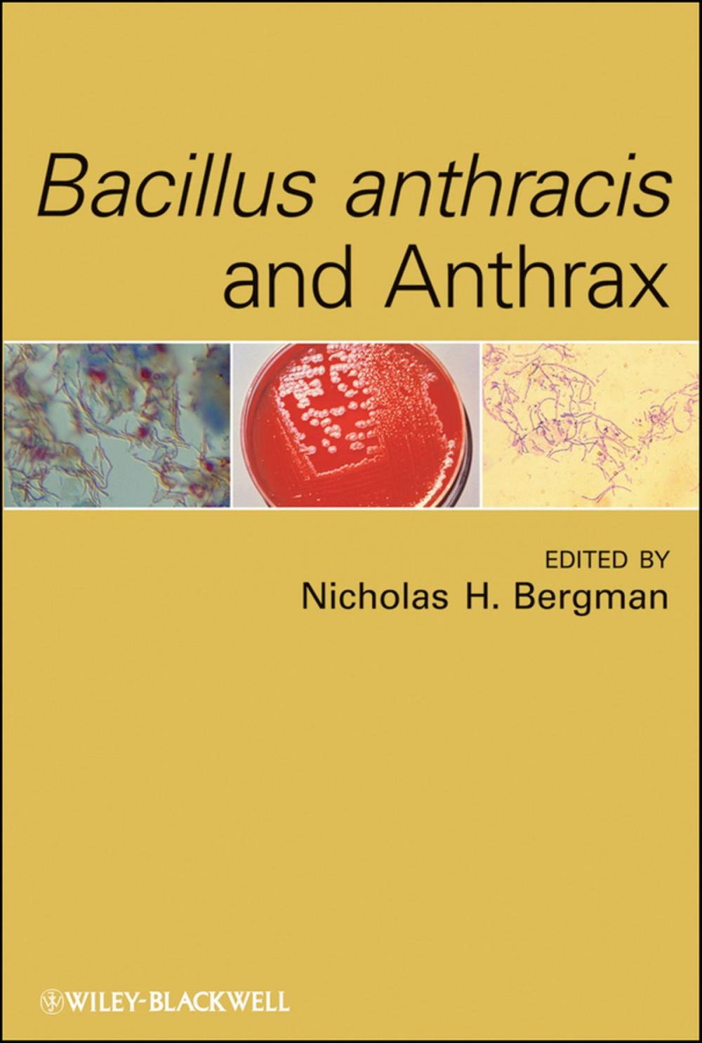 Big bigCover of Bacillus anthracis and Anthrax