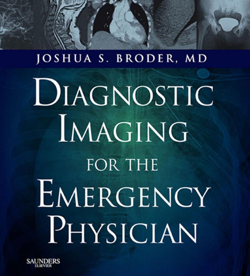 Big bigCover of Diagnostic Imaging for the Emergency Physician E-Book