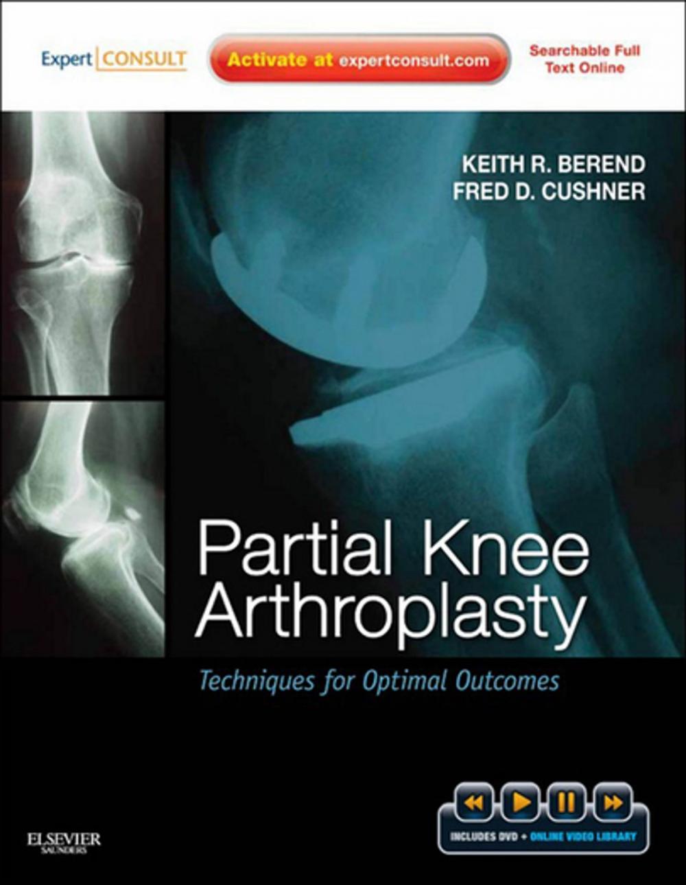 Big bigCover of Partial Knee Arthroplasty E-Book