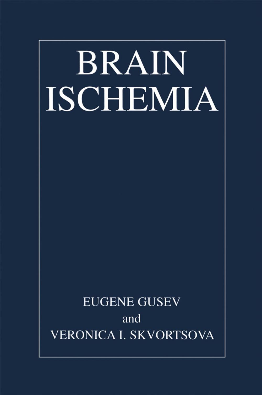 Big bigCover of Brain Ischemia