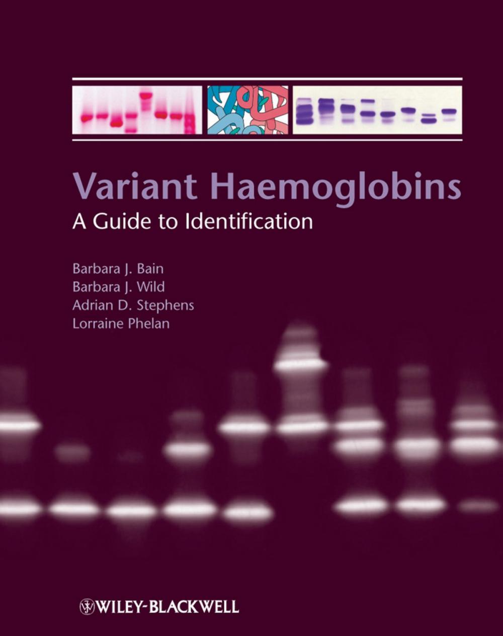 Big bigCover of Variant Haemoglobins