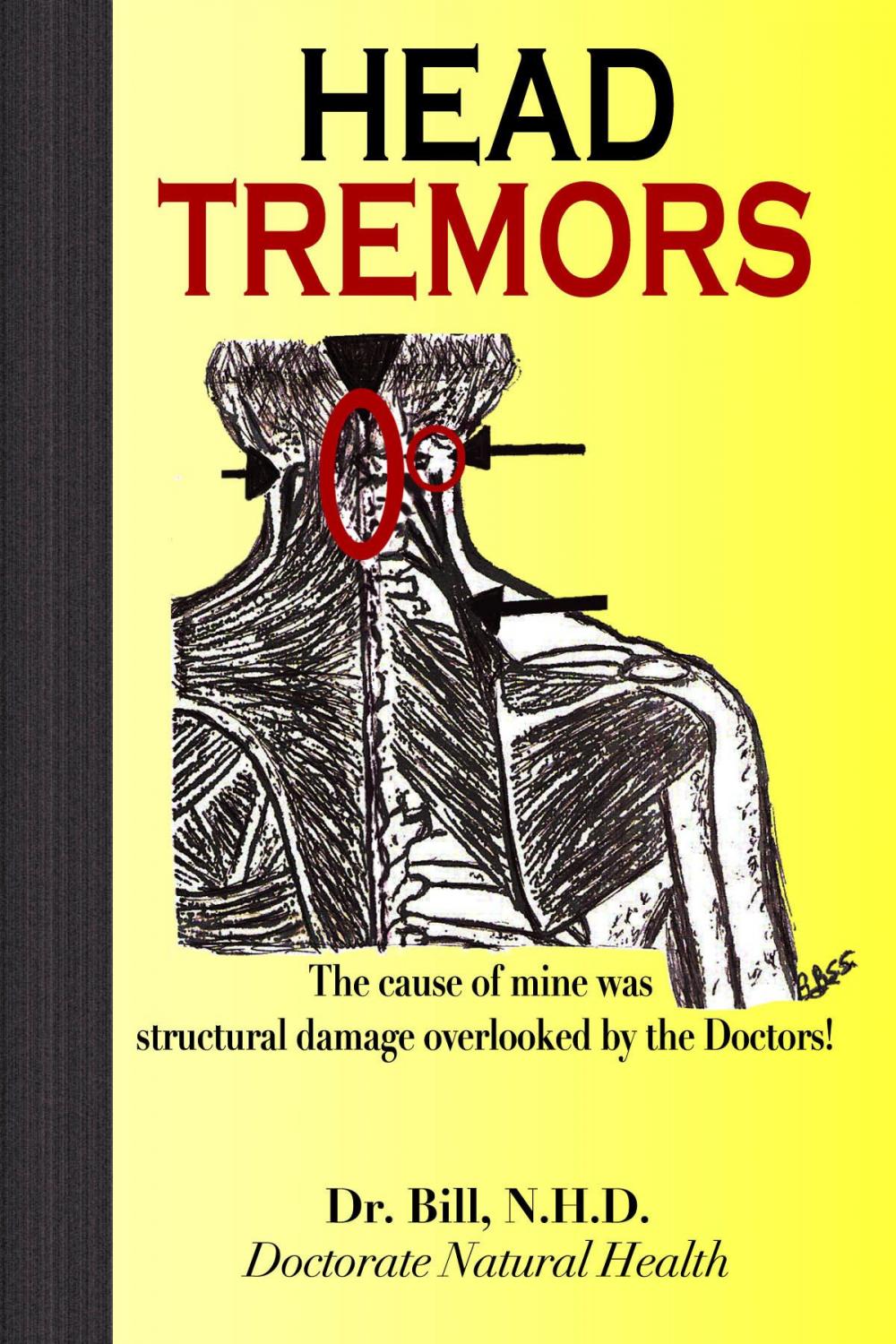 Big bigCover of HEAD TREMORS, the cause of mine overlooked by Doctors