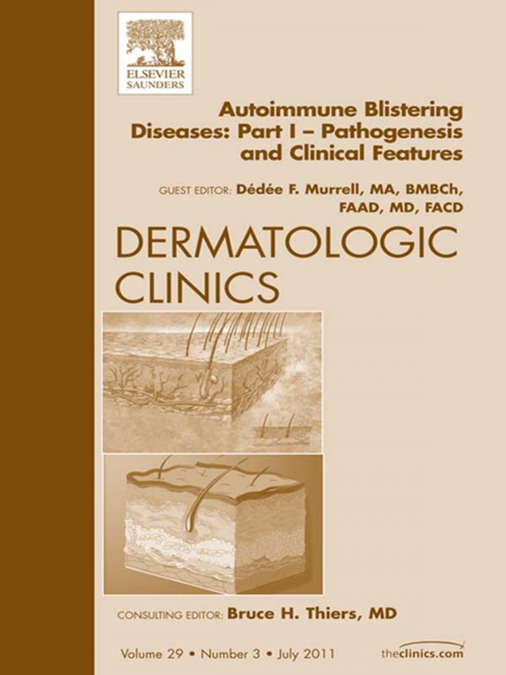 Big bigCover of AutoImmune Blistering Disease Part I, An Issue of Dermatologic Clinics - E-Book
