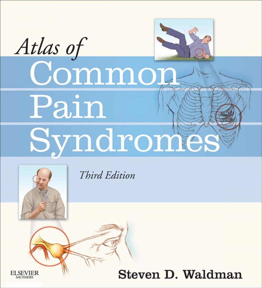 Big bigCover of Atlas of Common Pain Syndromes