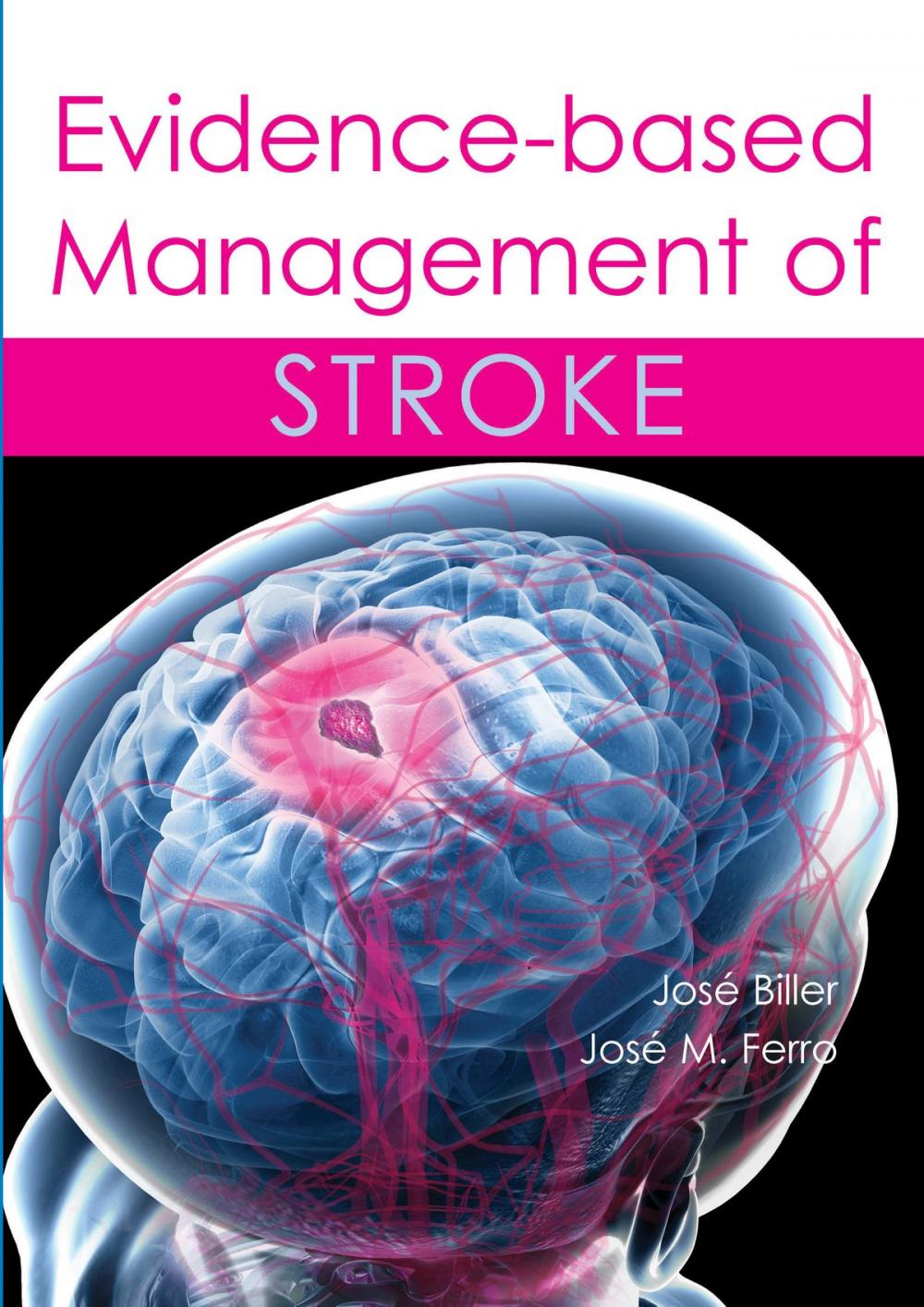 Big bigCover of Evidence-based Management of Stroke