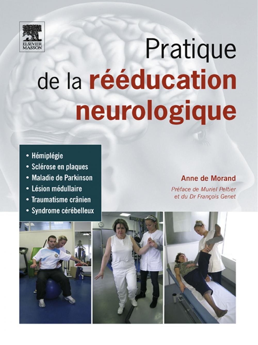 Big bigCover of Pratique de la rééducation neurologique