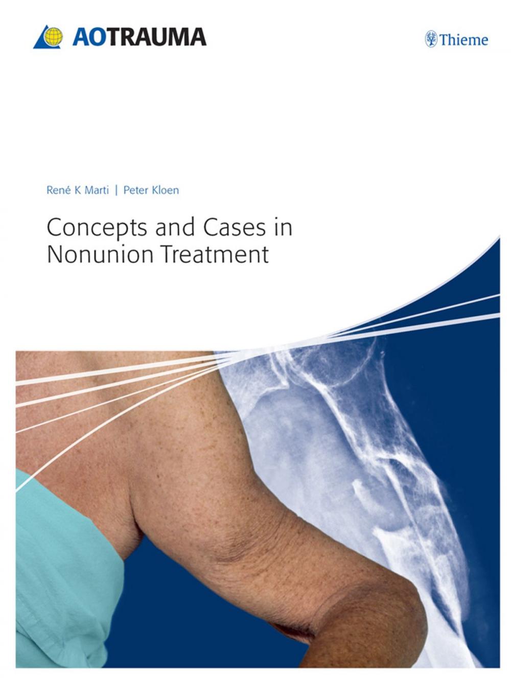 Big bigCover of Concepts and Cases in Nonunion Treatment