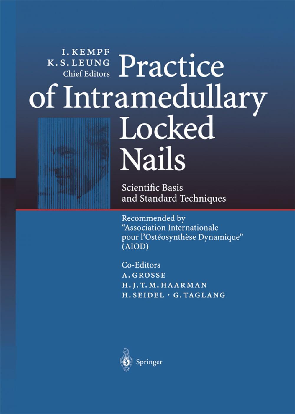 Big bigCover of Practice of Intramedullary Locked Nails