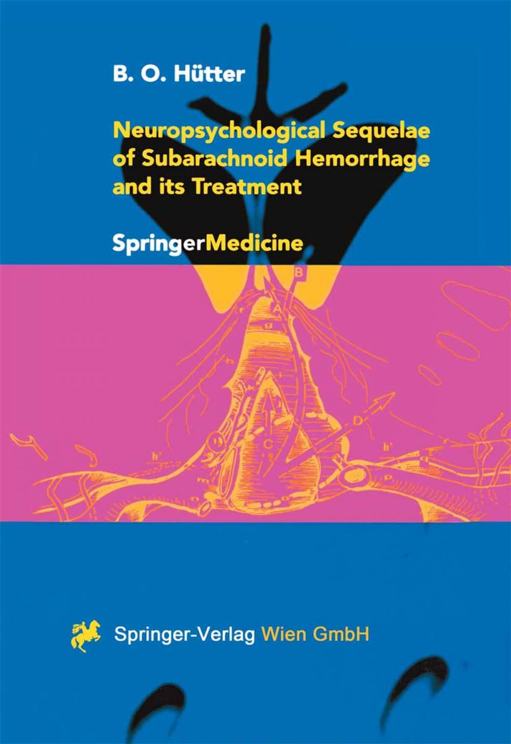 Big bigCover of Neuropsychological Sequelae of Subarachnoid Hemorrhage and its Treatment