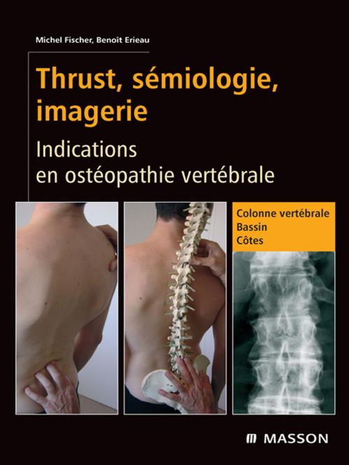 Cover of the book Thrust, sémiologie, imagerie by Michel Fischer, Benoît Erieau, Elsevier Health Sciences