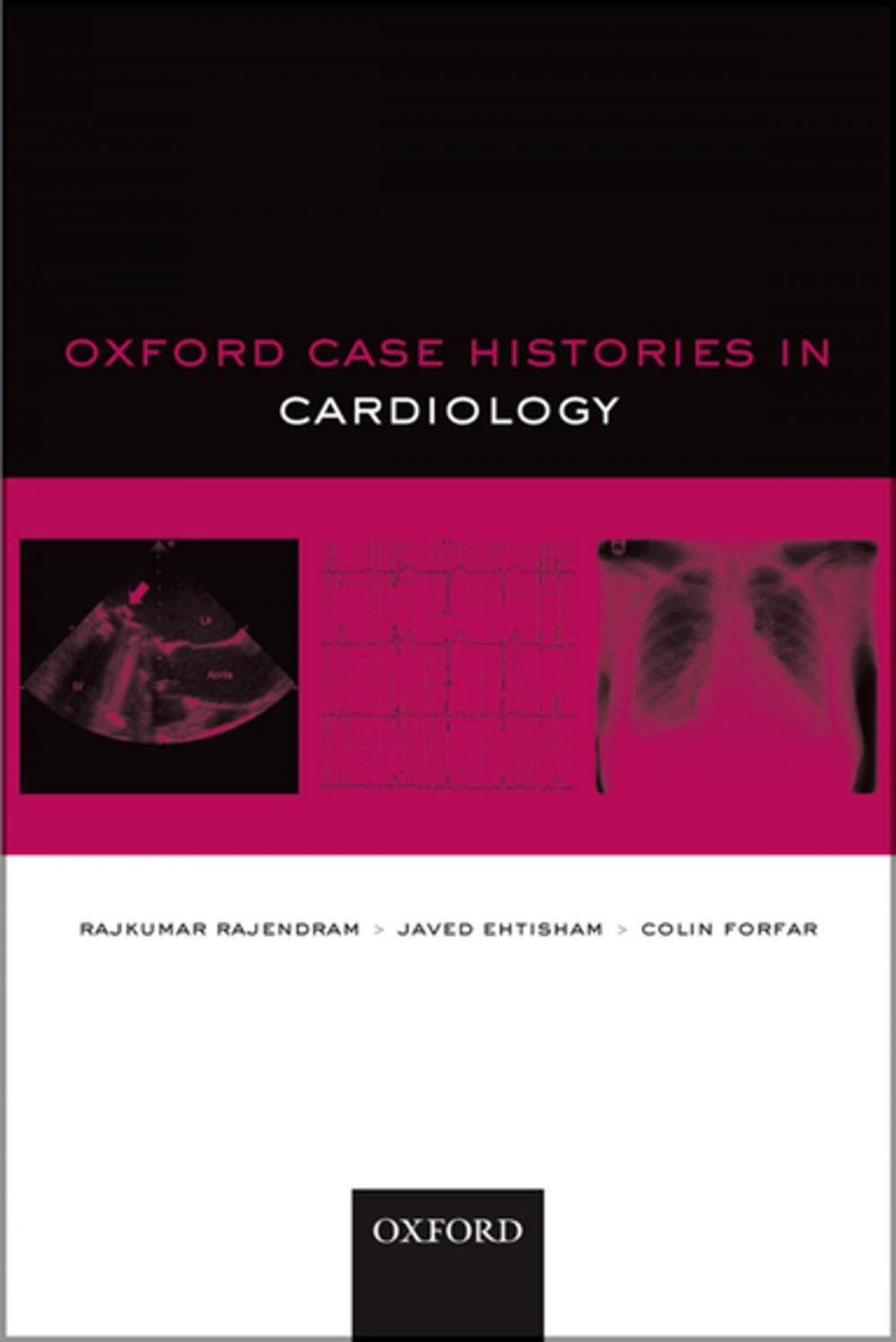 Big bigCover of Oxford Case Histories in Cardiology