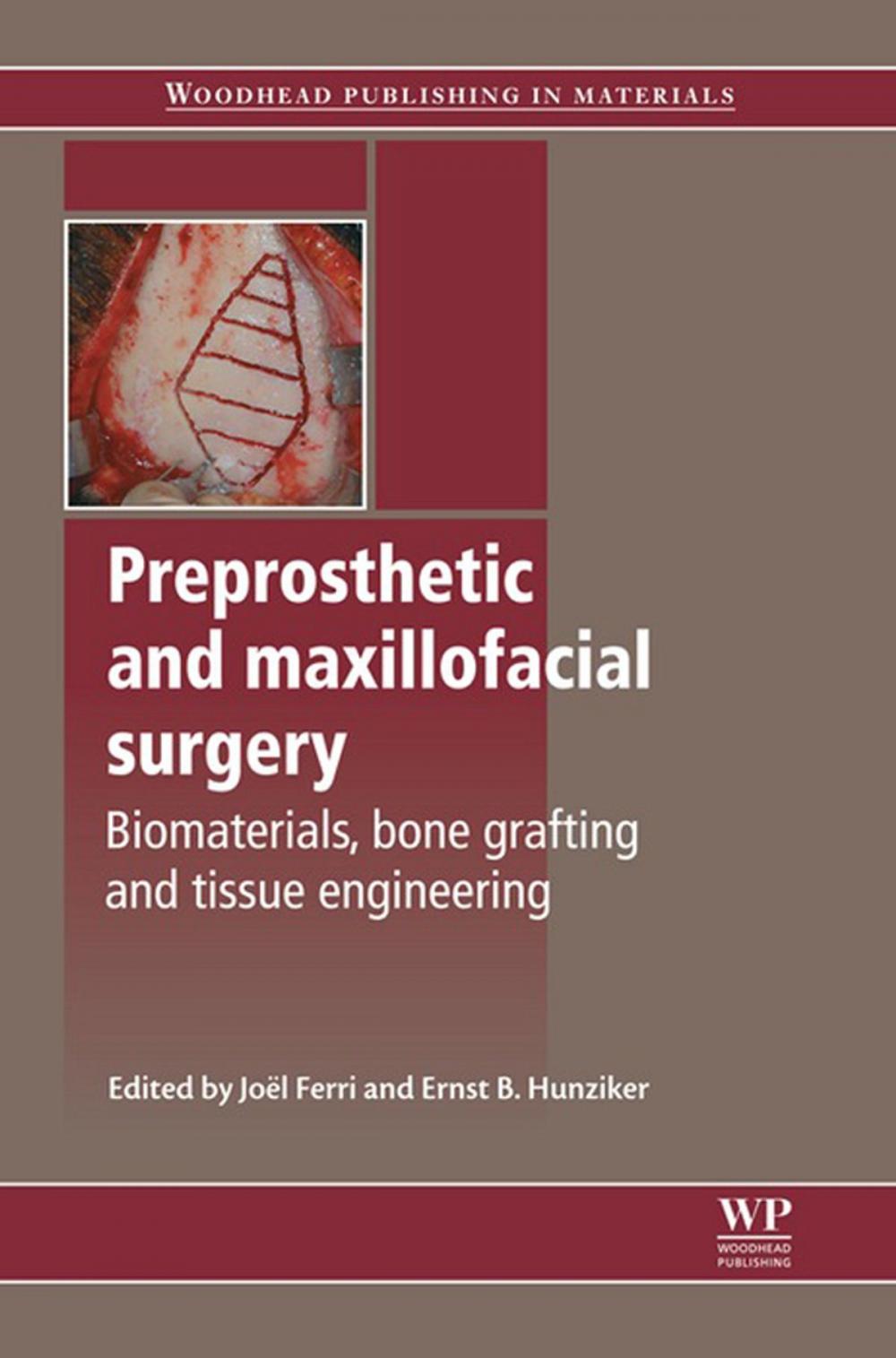 Big bigCover of Preprosthetic and Maxillofacial Surgery