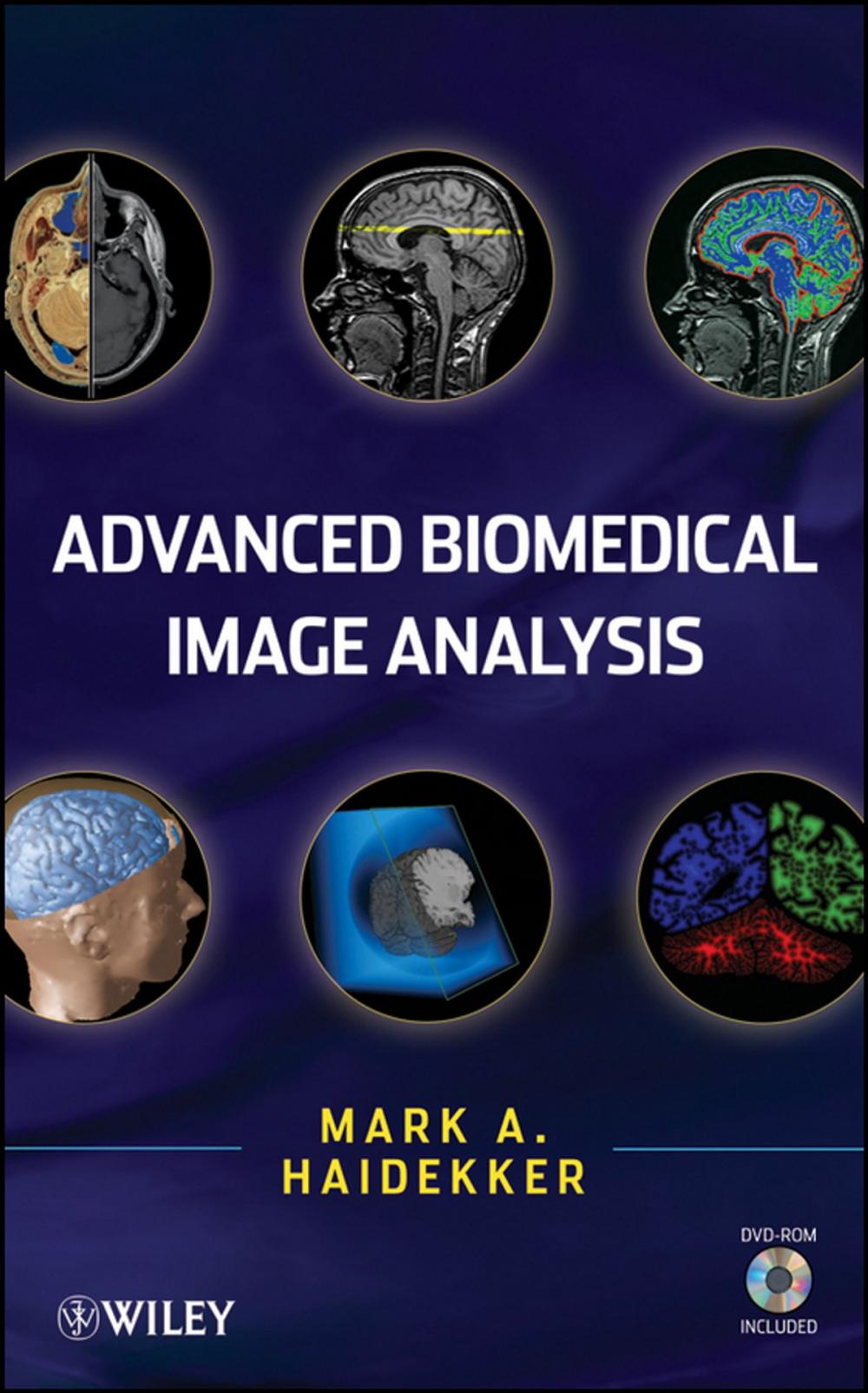 Big bigCover of Advanced Biomedical Image Analysis