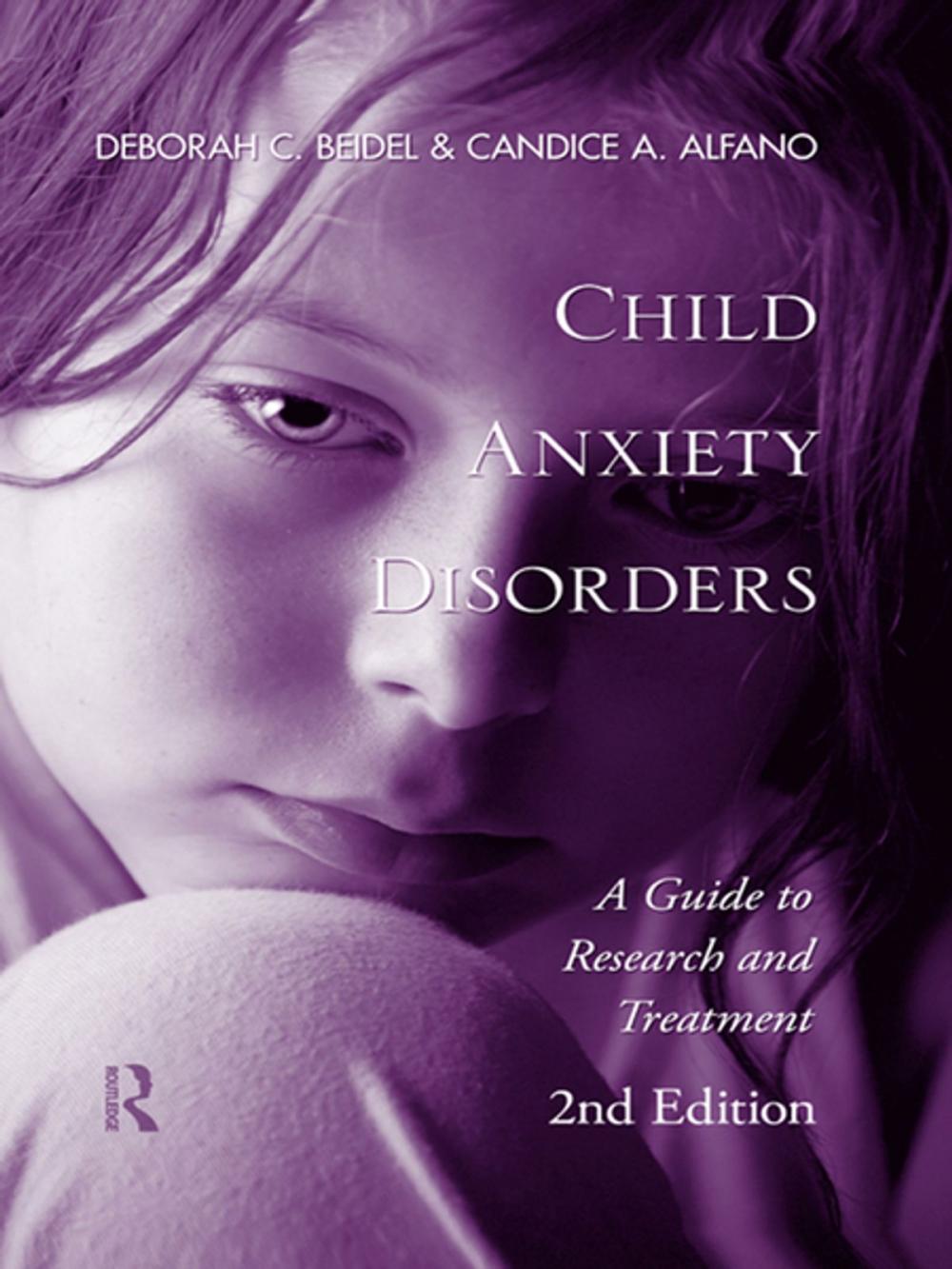 Big bigCover of Child Anxiety Disorders