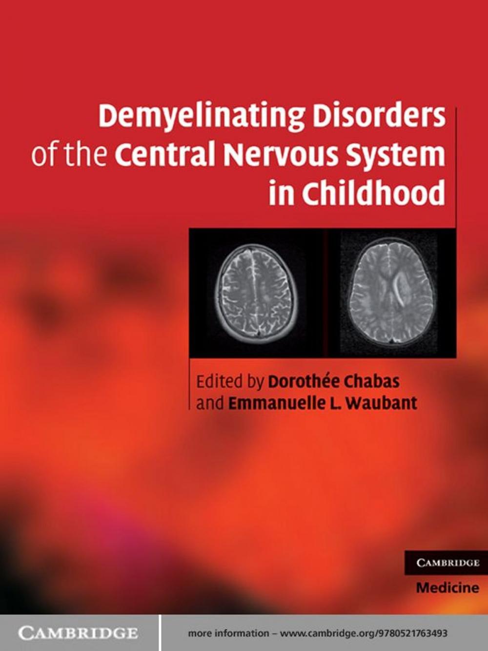 Big bigCover of Demyelinating Disorders of the Central Nervous System in Childhood