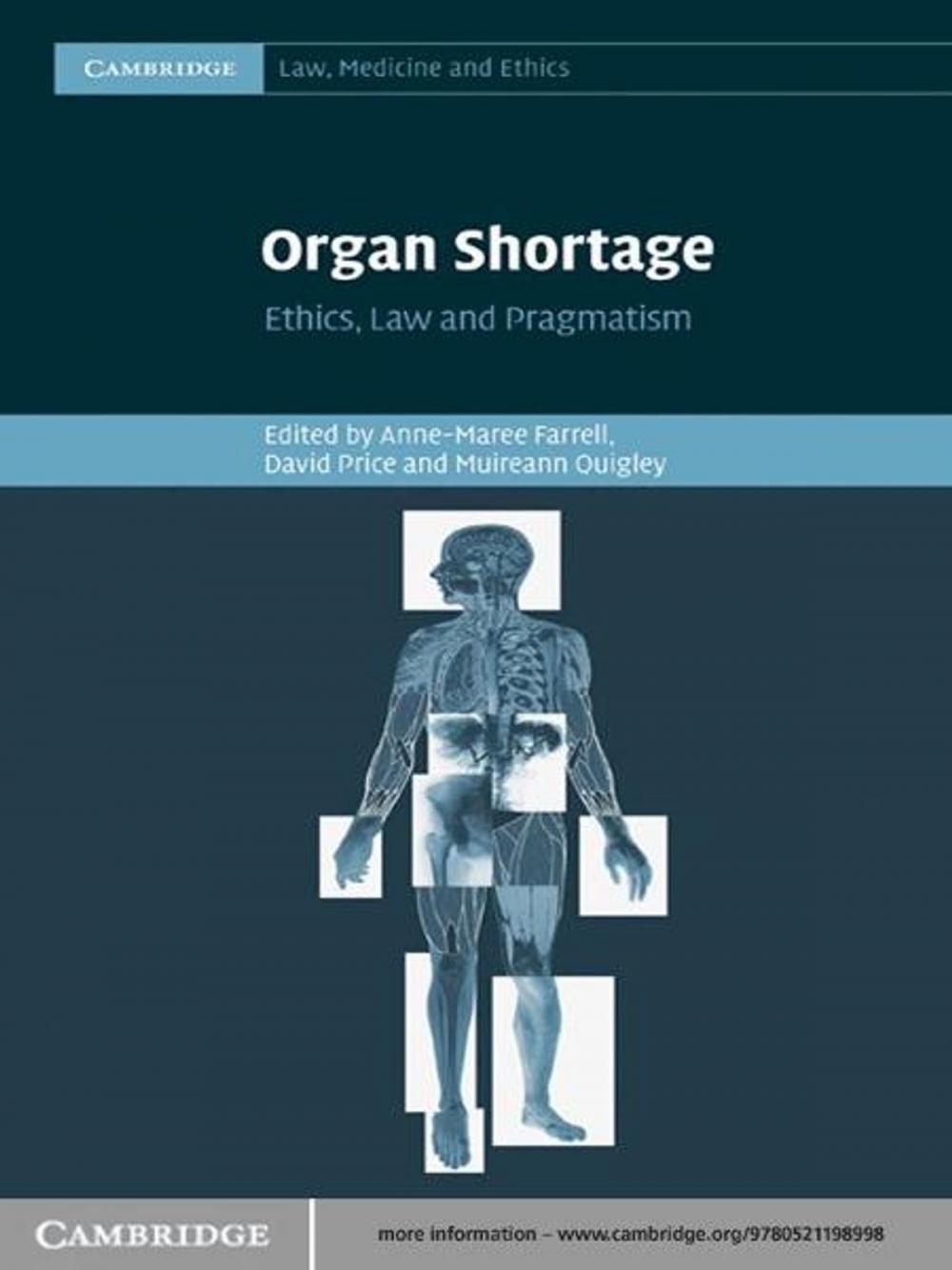 Big bigCover of Organ Shortage