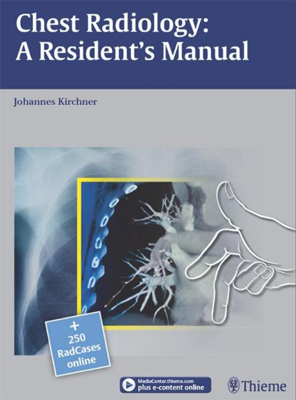 Big bigCover of Chest Radiology: A Resident's Manual