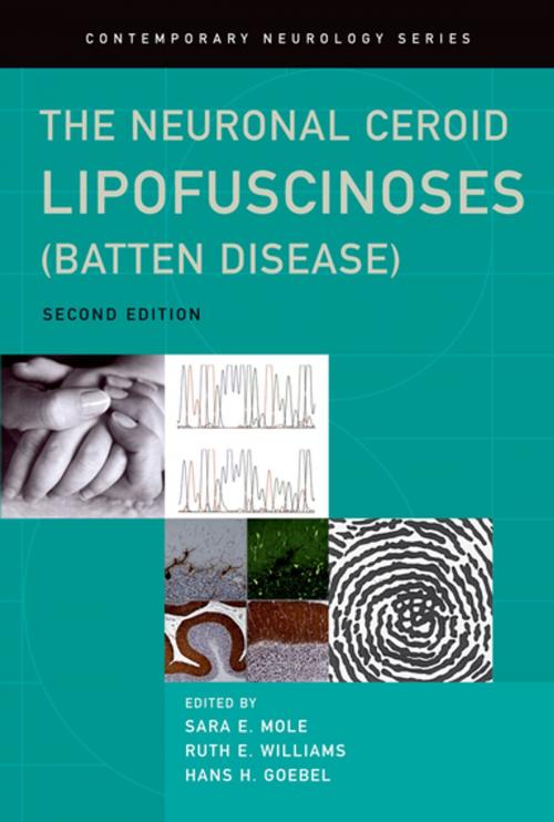 Cover of the book The Neuronal Ceroid Lipofuscinoses (Batten Disease) by , OUP Oxford