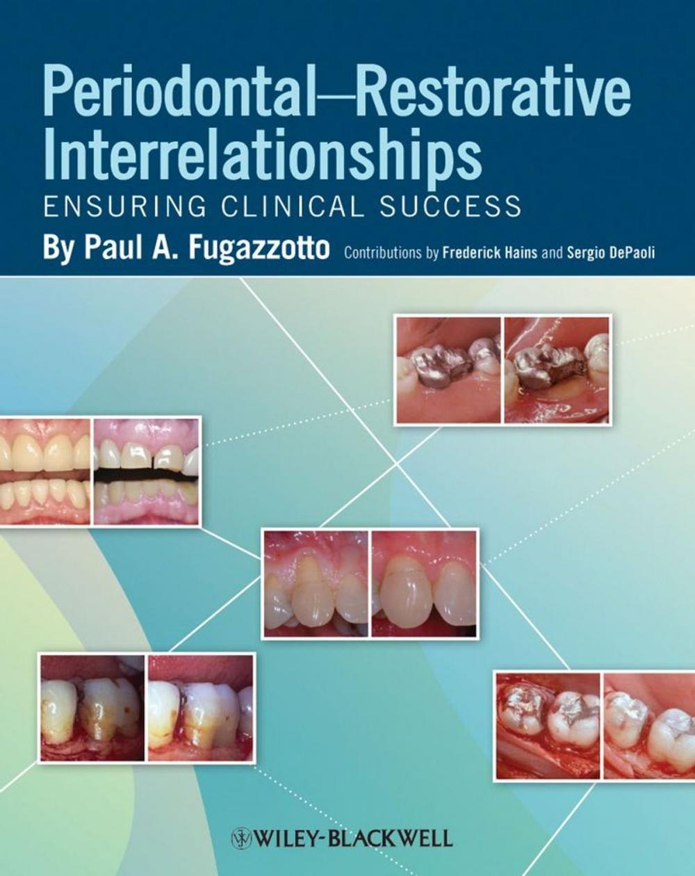 Big bigCover of Periodontal-Restorative Interrelationships