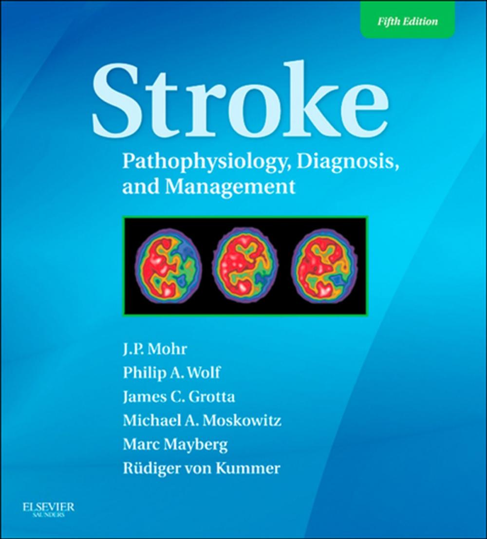 Big bigCover of Stroke E-Book