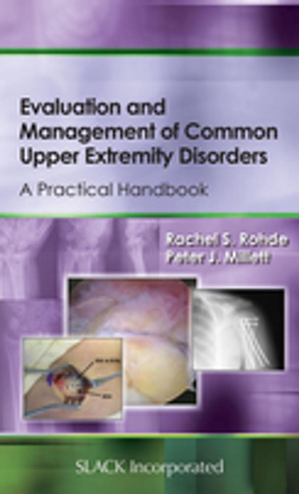 Big bigCover of Evaluation and Management of Common Upper Extremity Disorders