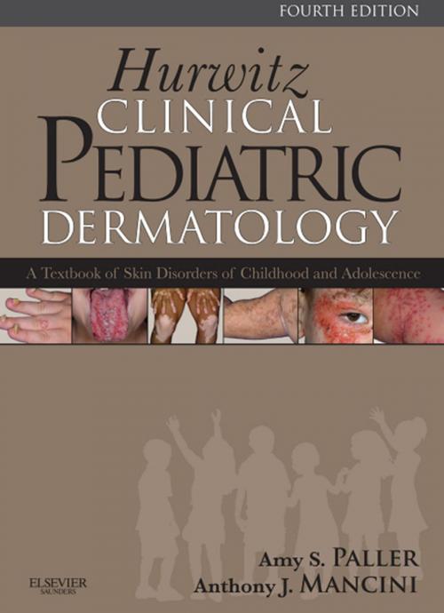 Cover of the book SPEC - Hurwitz Clinical Pediatric Dermatology E -Book 12Month Subscription by Amy S. Paller, MD, Anthony J. Mancini, MD, Elsevier Health Sciences