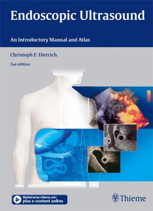 Cover of the book Endoscopic Ultrasound by Christoph Frank Dietrich, Thieme