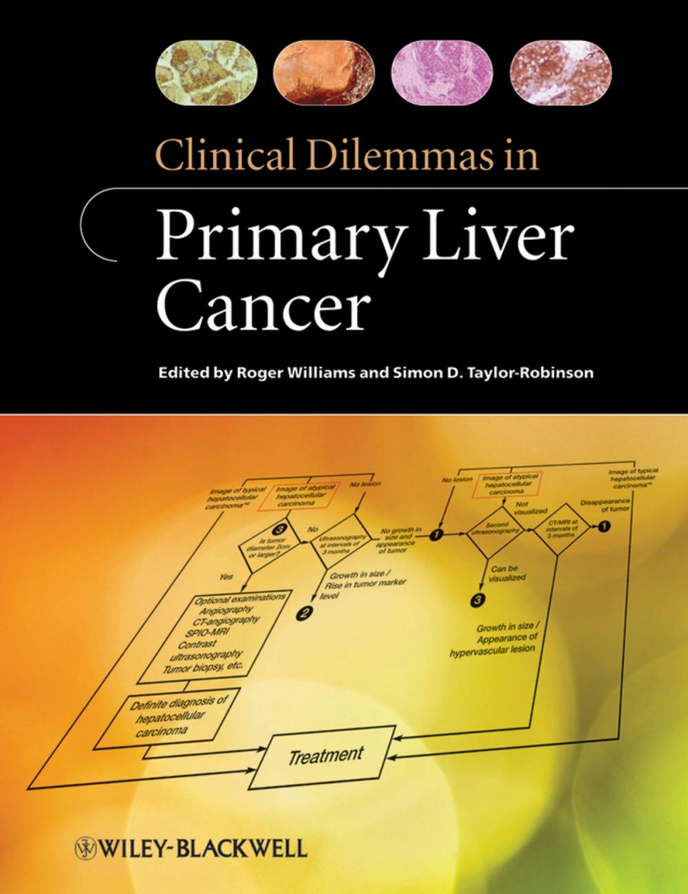 Big bigCover of Clinical Dilemmas in Primary Liver Cancer