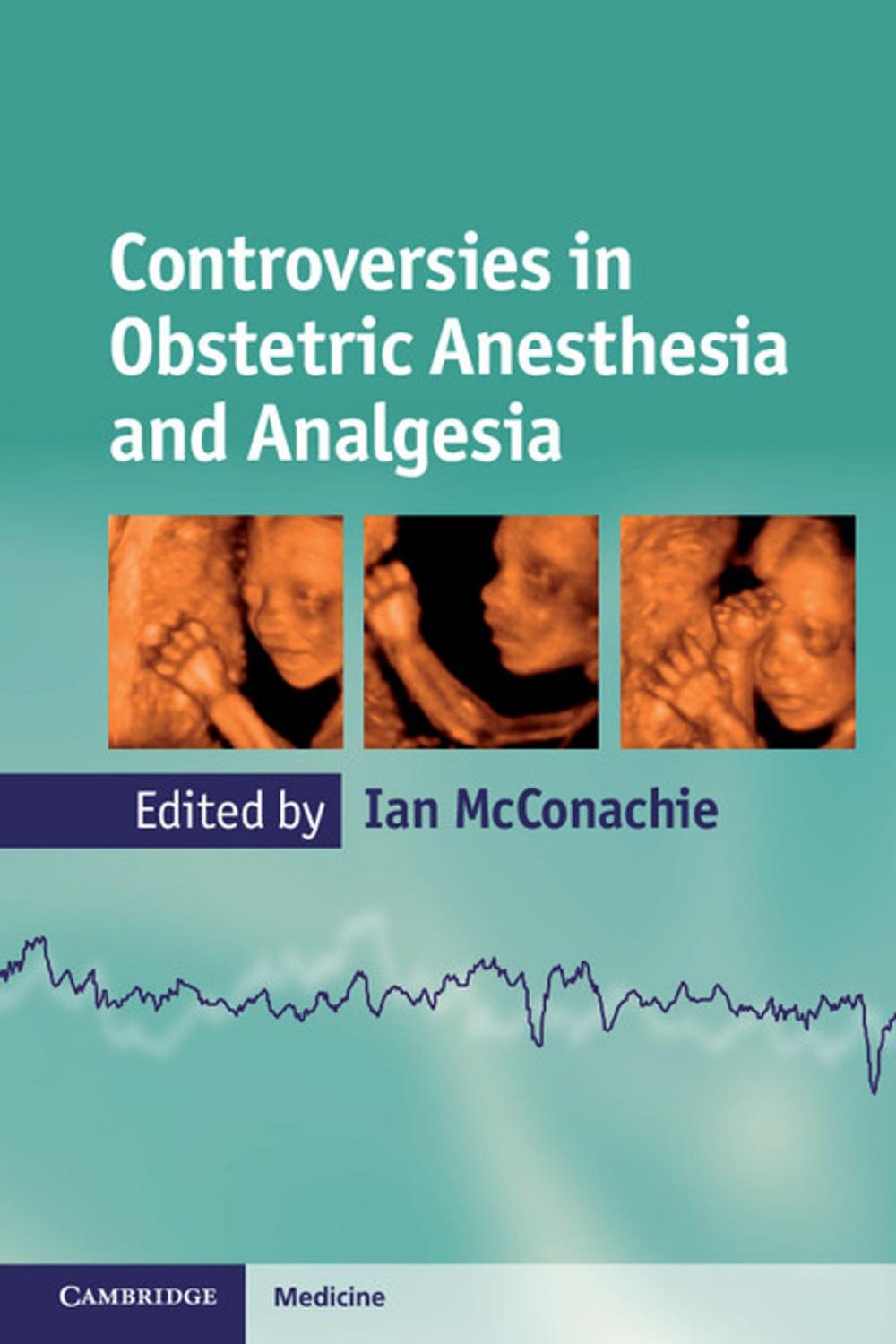 Big bigCover of Controversies in Obstetric Anesthesia and Analgesia