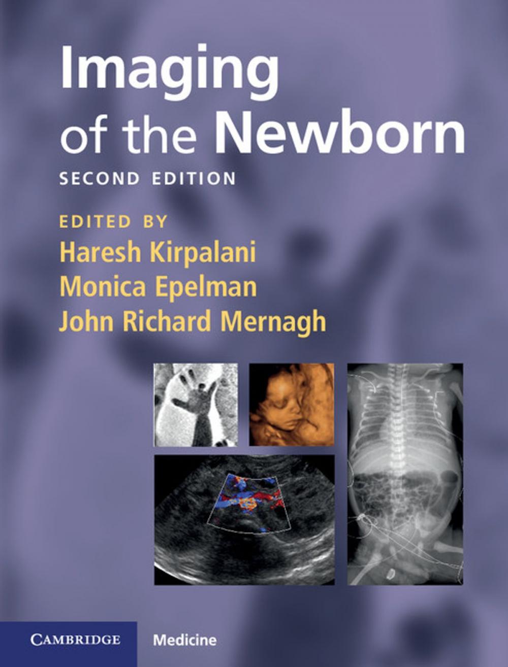 Big bigCover of Imaging of the Newborn