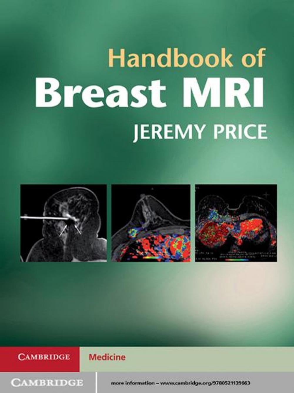 Big bigCover of Handbook of Breast MRI