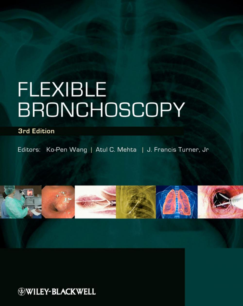 Big bigCover of Flexible Bronchoscopy