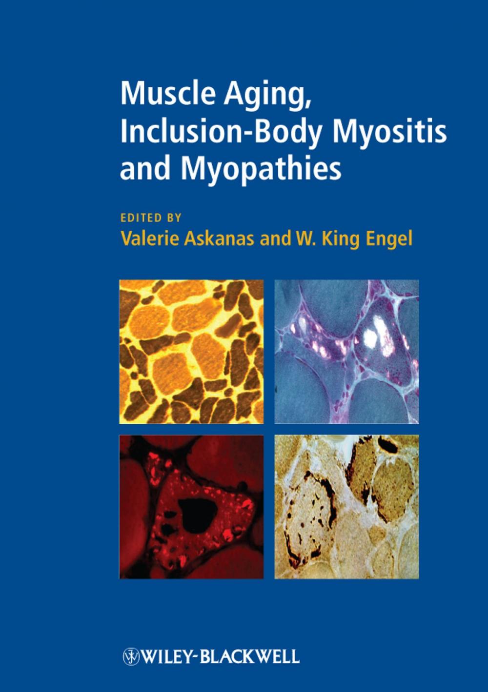 Big bigCover of Muscle Aging, Inclusion-Body Myositis and Myopathies