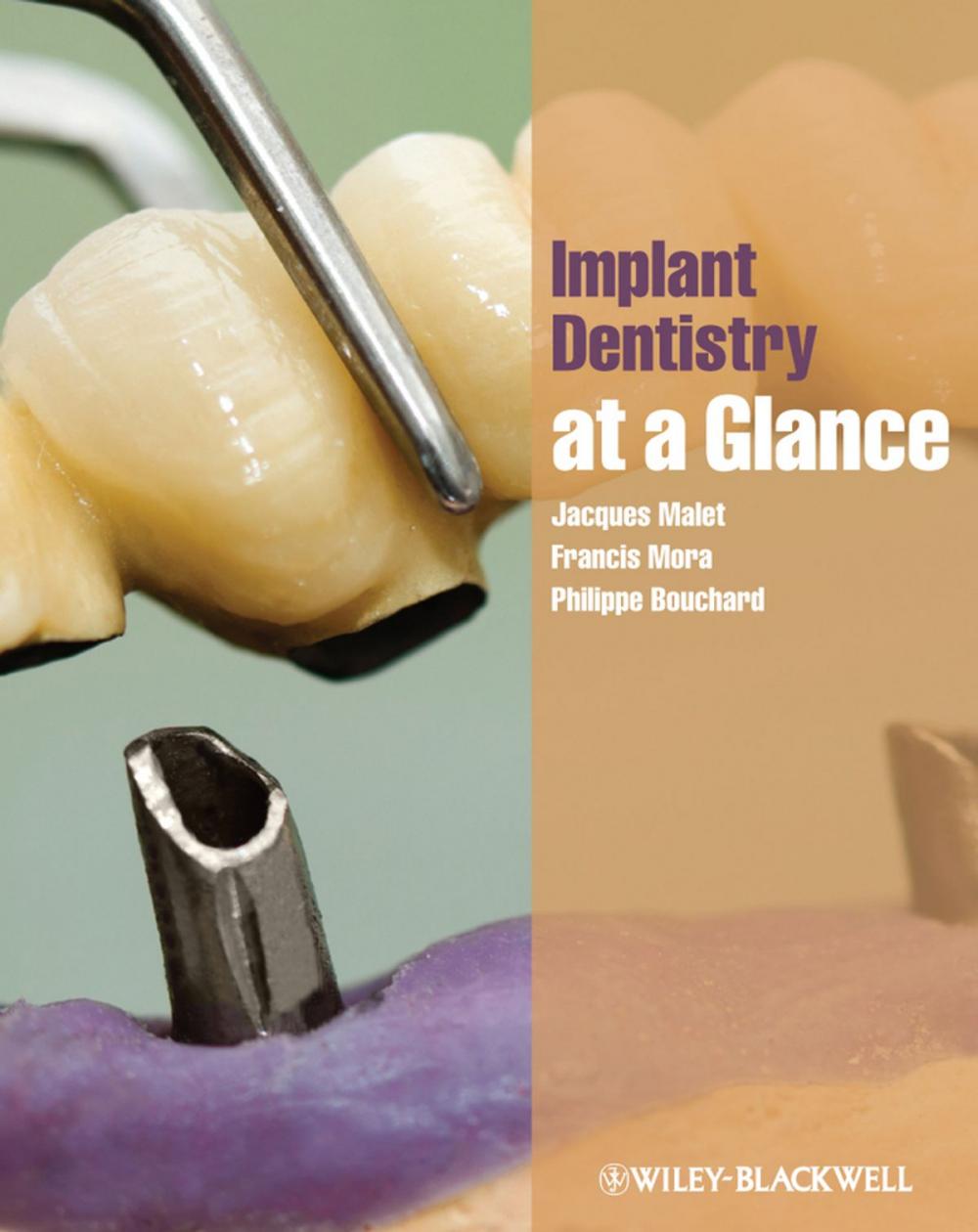 Big bigCover of Implant Dentistry at a Glance