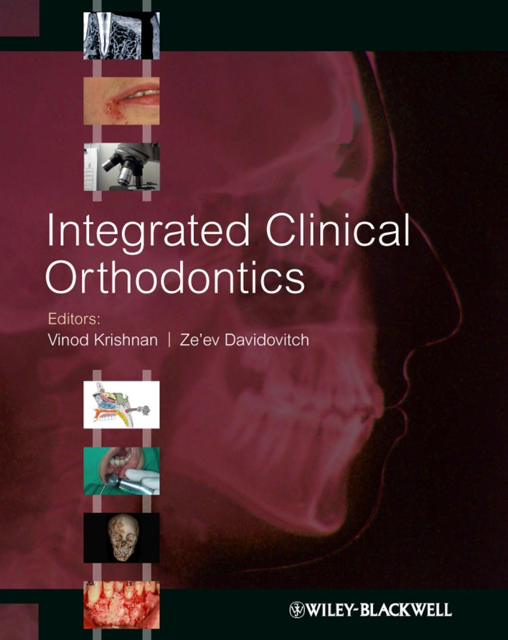 Big bigCover of Integrated Clinical Orthodontics