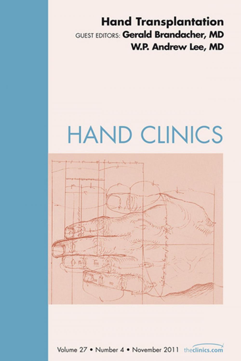 Big bigCover of Hand Transplantation, An Issue of Hand Clinics - E-Book