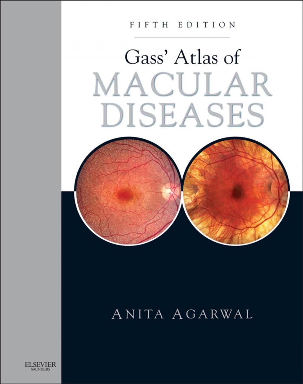 Big bigCover of Gass' Atlas of Macular Diseases E-Book