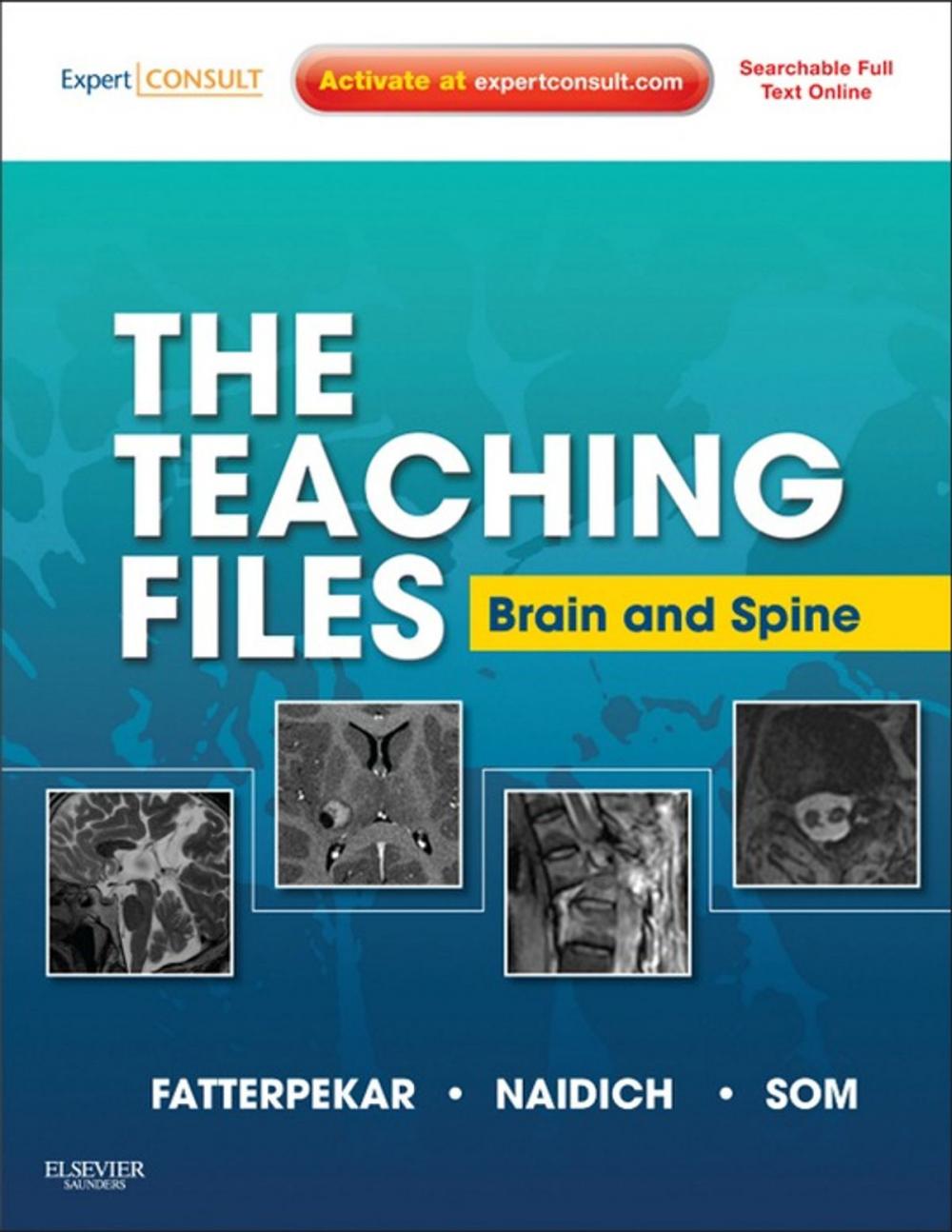 Big bigCover of The Teaching Files: Brain and Spine Imaging E-Book