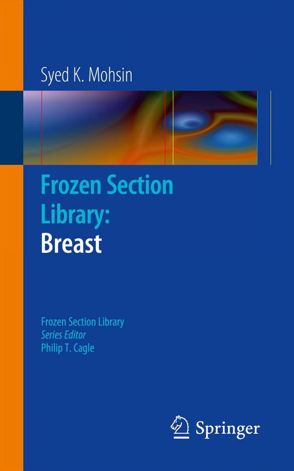 Big bigCover of Frozen Section Library: Breast