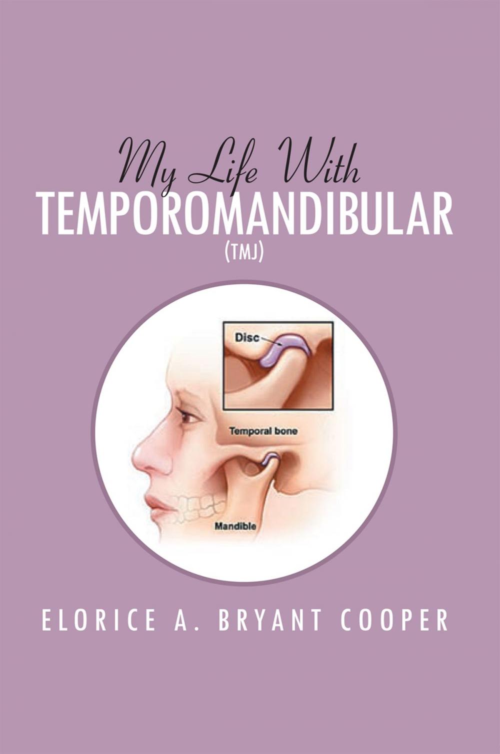 Big bigCover of My Life with Temporomandibular (Tmj)