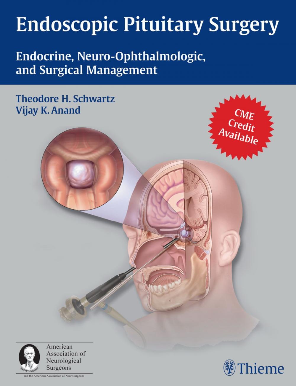 Big bigCover of Endoscopic Pituitary Surgery